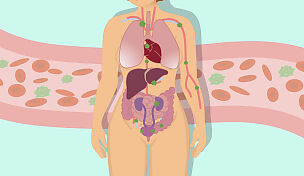 l2-maternal-sepsis-id10093-01.jpg